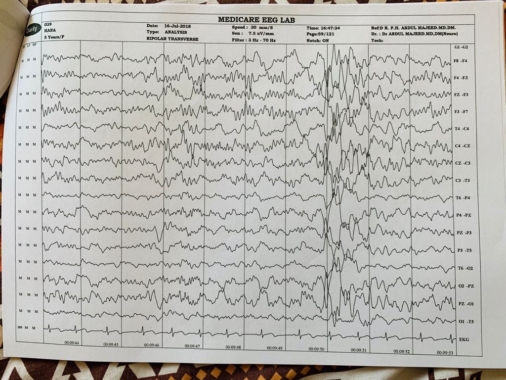 Patient Story